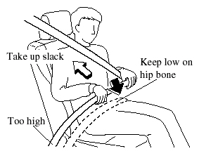 4. Position the lap belt as low as possible, not on the abdominal area, then